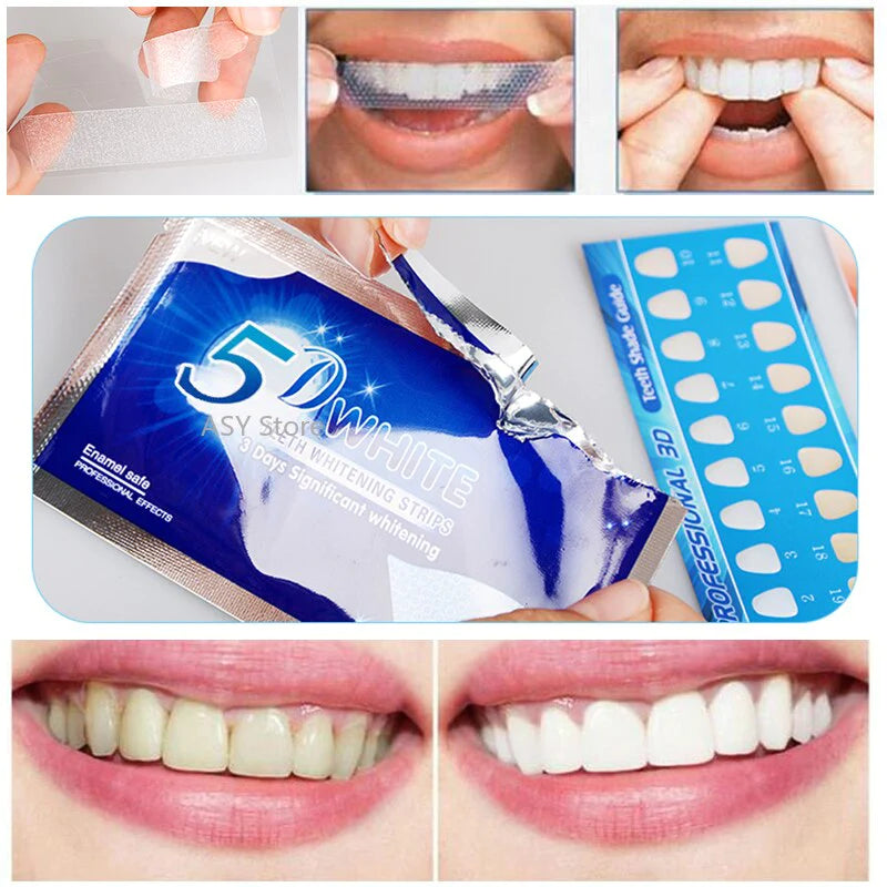 PAP+  O Super Adesivo para Clareamento Dental