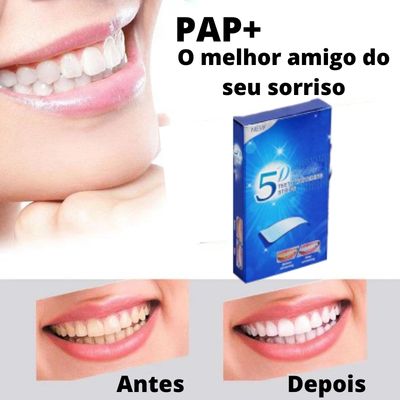 PAP+  O Super Adesivo para Clareamento Dental